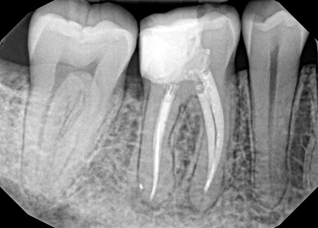 Dental X-rays